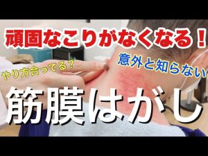 【首コリ　肩こり　ケア】『こりがなくなる！　器具で行う筋膜はがし』【北千住　接骨 整骨院】